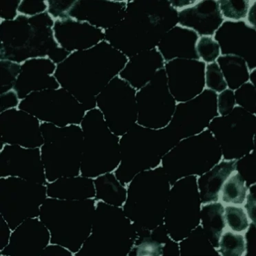 Gut cells damaged by glyphosate